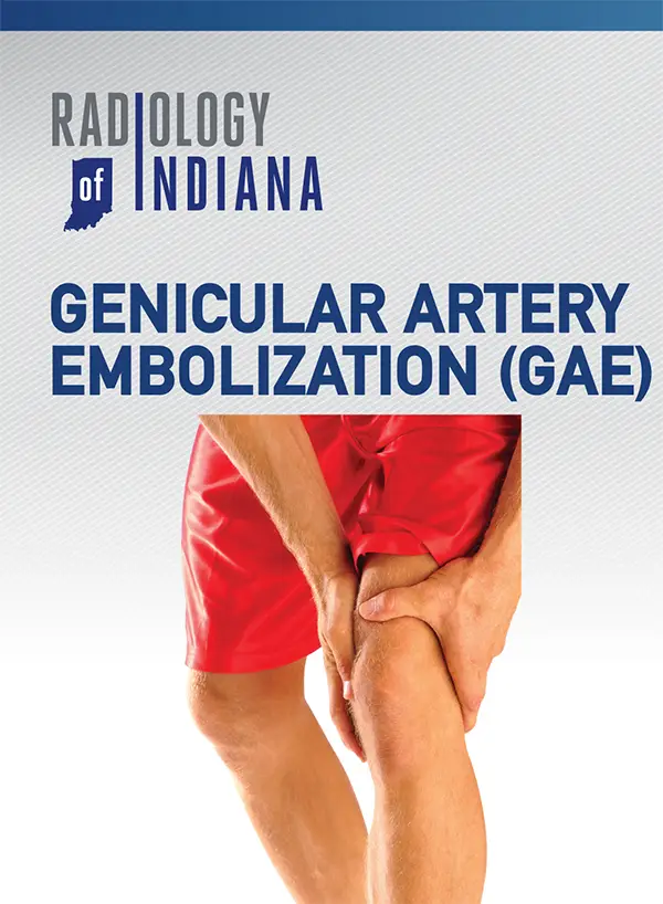 Genicular Artery Embolization BROCHURE