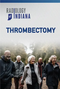 Thrombectomy Brochure